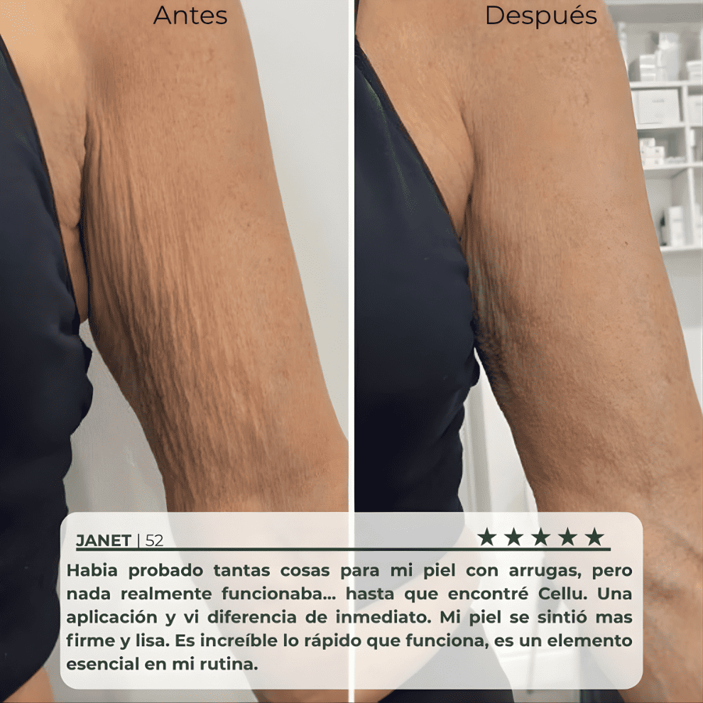 Tratamiento Reafirmante y Anti Celulitis